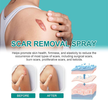 Scar Spray